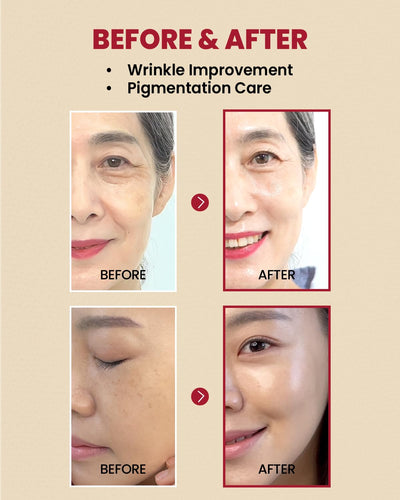 K‑SECRET - SEOUL 1988 Serum: Retinal Liposome 2% + Black Ginseng